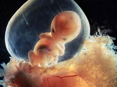 双子座试管宝宝——胎停、流产、畸形，一定不能忽视精子质量！ - 知乎