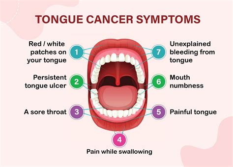 Best Oral/Tongue Cancer Specialist in Delhi – Dr. Priya Tiwari