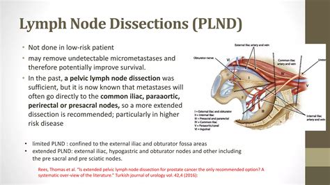 Carcinoma Of Prostate and its management | PPTX
