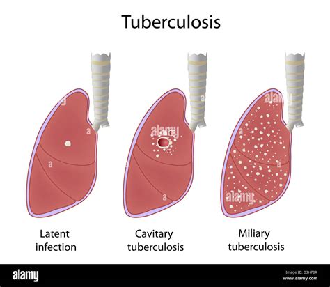Images of tb - JapaneseClass.jp
