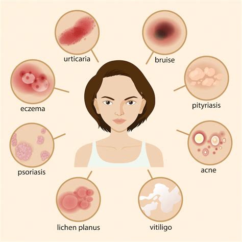 Image result for Different Types of Skin Conditions