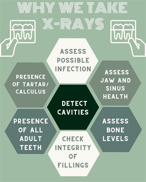 Why do we take x-rays at the dentist? | Dental facts, Dental fun, Dental marketing