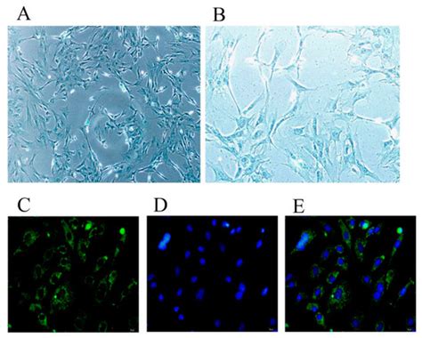 Analyses of Transcriptomics upon IL-1β-Stimulated Mouse Chondrocytes ...