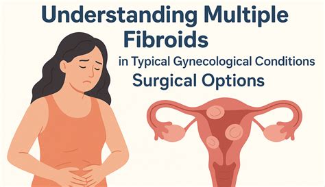 Understanding Multiple Fibroids in Typical Gynecological Conditions ...