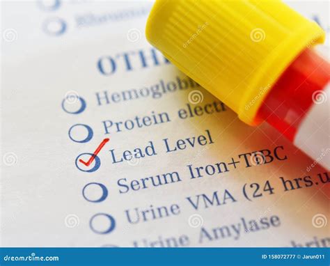 Blood Sample for Lead Level Test Stock Image - Image of research, diesel: 158072777