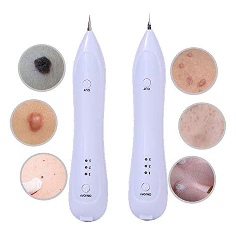 Electric Face Wart Tag Remaval Mole Dark Spot Remover Freckle Removal ...