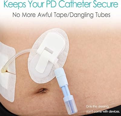DiaBelt Peritoneal Dialysis PD Catheter Holder Adhesive India | Ubuy