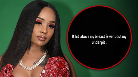 Rapper Stunna Girl Says She Was Shot in Chest, Posts Gruesome Injury | News Pub