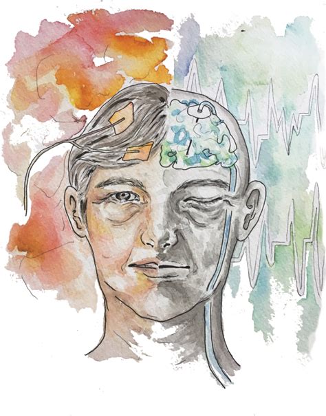 Image result for Non-Invasive Brain Stimulation