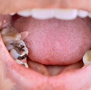 Best Dental Clinic in Delhi, Dwarka - OrthoMax
