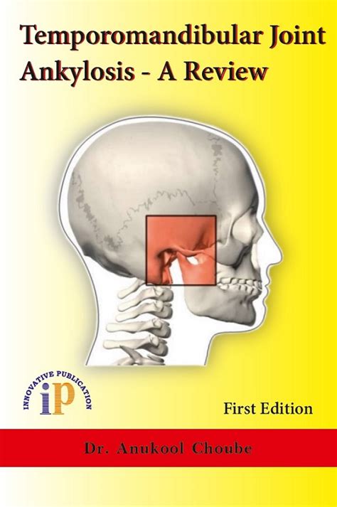 Temporomandibular Joint Ankylosis – A Review - All India Book House