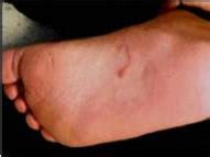 Print Image Gallery Question - Pediatric Oncall