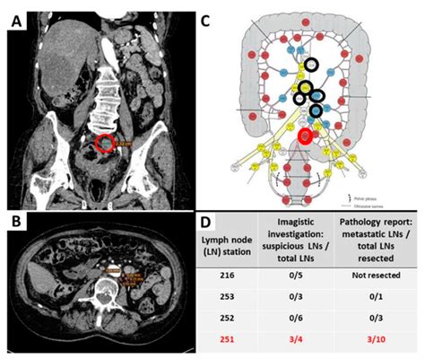 Rectal Cancer Staging