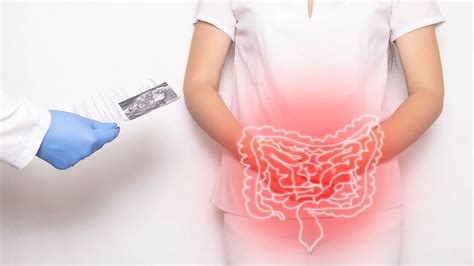 Neue Therapieoptionen bei akuter myeloischer Leukämie - Innere Medizin ...