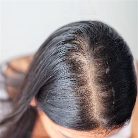Why Is My Hair Parting Getting Wider? Causes and How to Fix