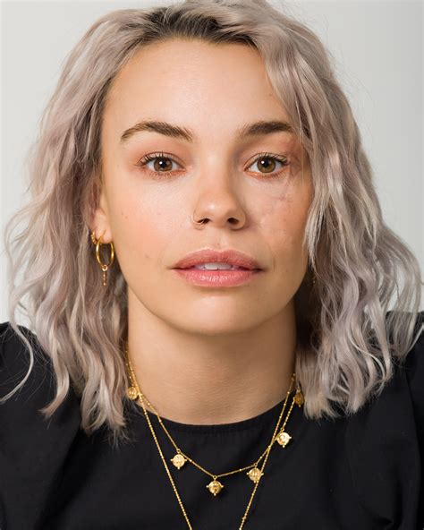 Phyllida Swift – activist and CEO of Face Equality International – AXSChat