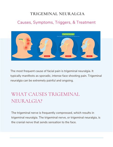 PPT - Trigeminal Neuralgia: Causes, Symptoms, Triggers, & Treatment ...
