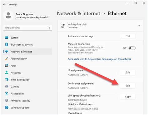 Image result for DNS Server Assignment