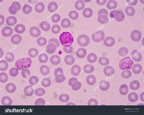 2,238 imágenes de Plasmodium malaria - Imágenes, fotos y vectores de stock | Shutterstock