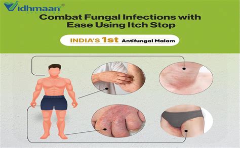 Vidhmaan Ayurveda Marham Dad Khaj Khujli Itch Coat fungal Malam ...