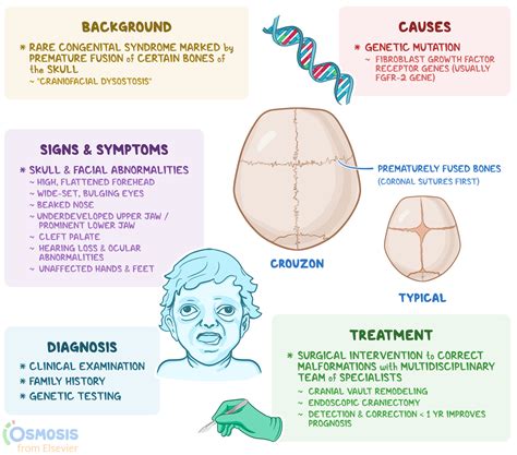 Craniosynostosis Pfeiffer Syndrome