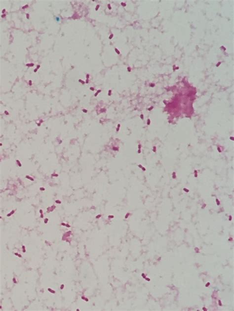 Haemophilus influenzae〔インフルエンザ桿菌〕 | グラム染色: Gram Stain