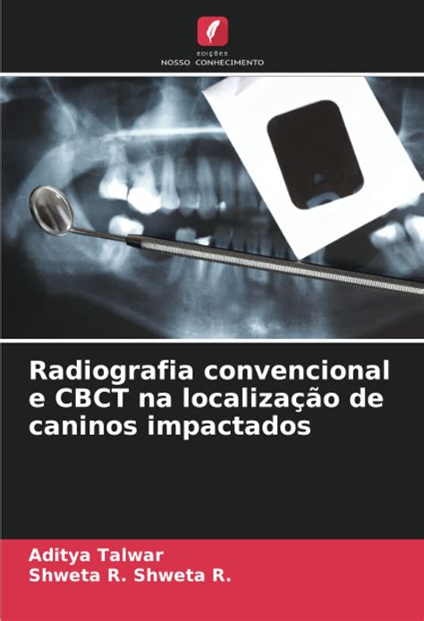 Buy Radiografia convencional e CBCT na localização de caninos ...