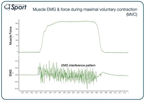 Image result for Muscle Activity EMG