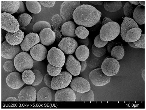 真菌是一类什么样的生物呢？真菌究竟是植物还是动物呢？_腾讯新闻