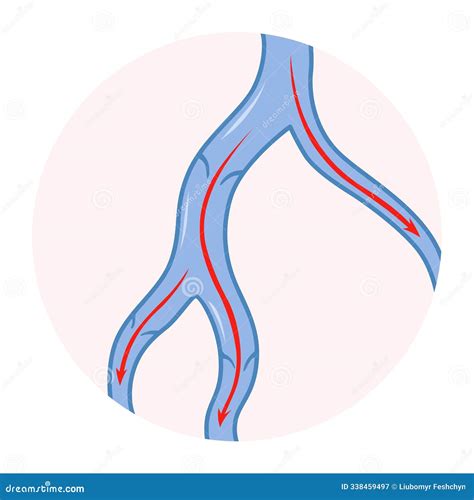 Varicose Veins. Blue Blood Vessel Visible through the Skin. Vascular Disease Diagnostic and ... - treat venous disease