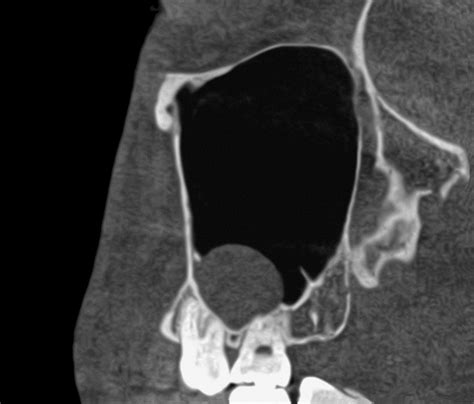 Präimplantologisch-radiologische Diagnostik | News | Quintessenz Verlags-GmbH