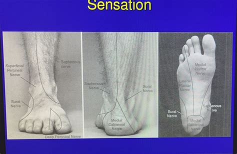 Lower Extremity Exam 的图像结果