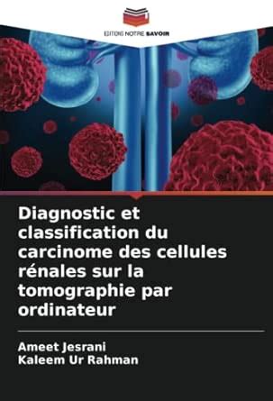Buy Diagnostic et classification du carcinome des cellules rénales sur ...