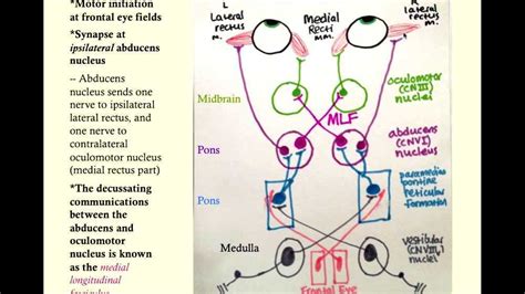 Image result for Contralateral Homonymous Hemianopsia