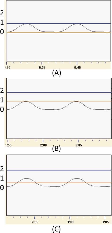 Image result for SimpleSolutions Thresholds Install