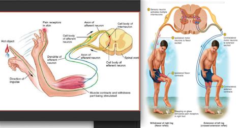 Image result for Contralateral Reflex Example