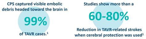 TAVR Stroke Risk : Aortic Valve Stenosis - Boston Scientific