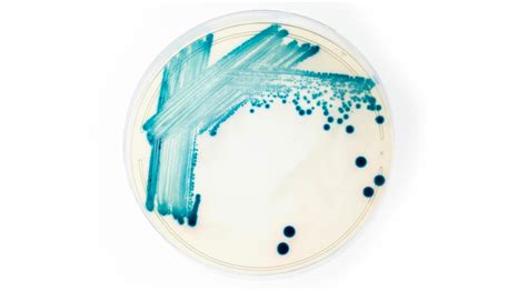 Bacterial Streak Plate