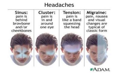 Kuvatulokset haulle causes of headaches