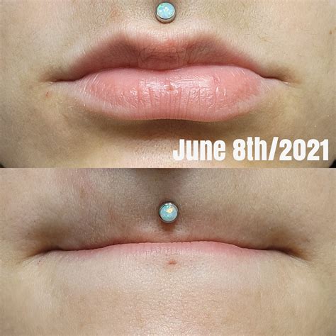 Vertical Labret Piercing Ring
