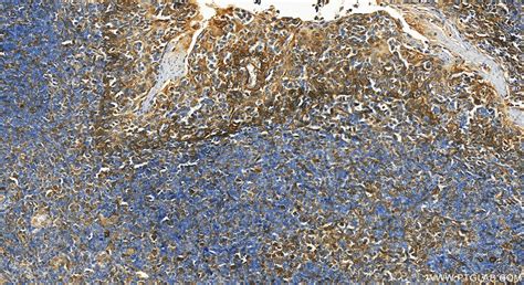B7-H3/CD276 antibody (14453-1-AP) | Proteintech
