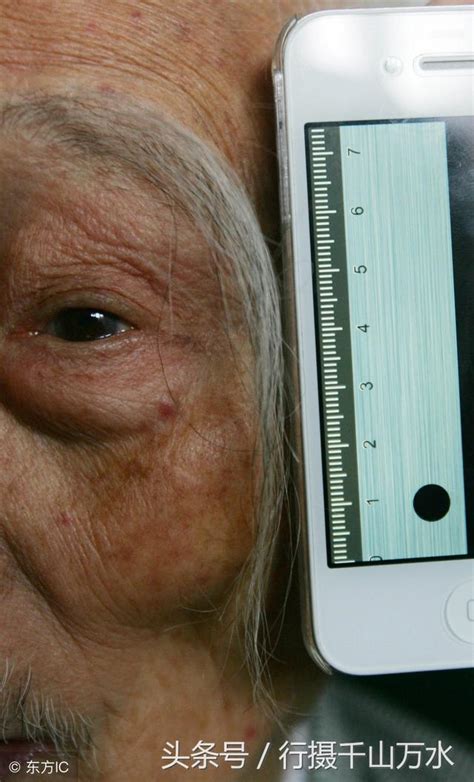 男性老年后，眉毛变长代表长寿？或许和疾病有关 - 知乎