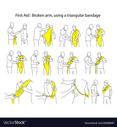 First Using Triangular Bandage 的图像结果
