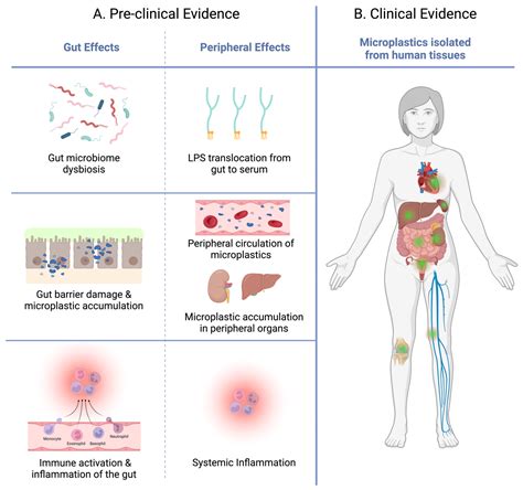 Mind over Microplastics: Exploring Microplastic-Induced Gut Disruption ...