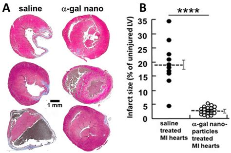 α-Gal Nanoparticles Mediated Homing of Endogenous Stem Cells for Repair ...