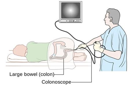 Colonoscopy Test Cost In India 2026 - Doctors Finder