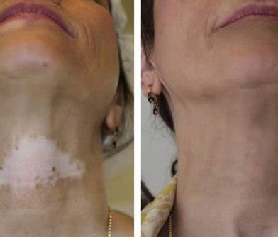 Cosderma Clinic | Expert Skin, Hair & Wellness Care