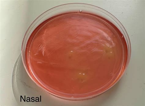 Image result for Enterococcus Faecalis MSA Plate