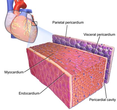 Pericarditis, myocarditis & perimyocarditis: ECG, criteria & treatment ...