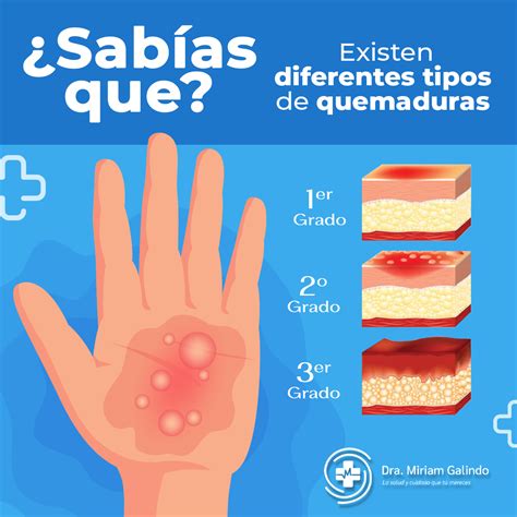 Quemaduras Primer Grado Primeros Auxilios Dr. Glenn